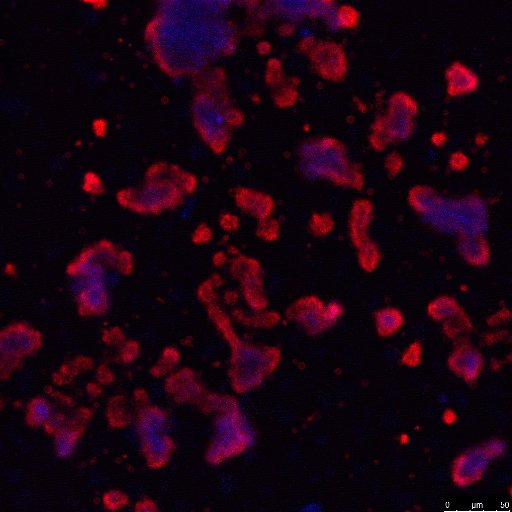 The Gardiner Group - Mechanisms of Thrombosis and Cancer, John Curtin School of Medical Research ANU