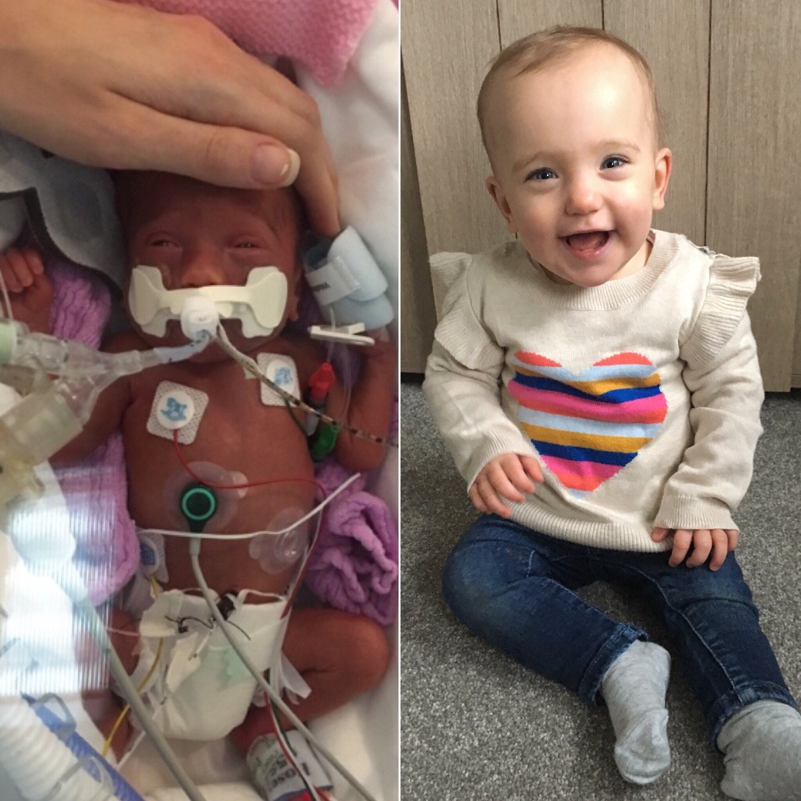 Running and cycling the 116 mile journey my daughter took to receive life saving treatment after being born prematurely at 27 weeks https://t.co/CUcQAtPfO4