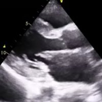 UBC POCUS (@ubcpocus) 's Twitter Profile