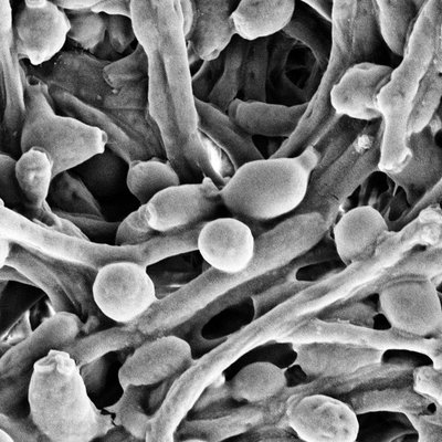 Summary of the play candida by george bernard shaw picture