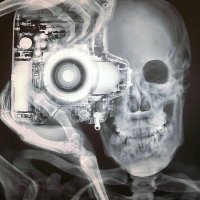 UCHealthRAD (@rad_uc) 's Twitter Profile Photo UCHealthRAD (@rad_uc) 's Twitter Profile Photo