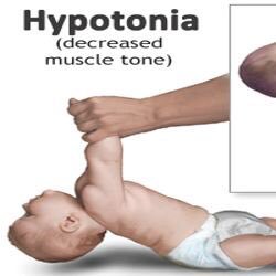 Raising funds and awareness for my hypotonia 18month old little girl ♥️