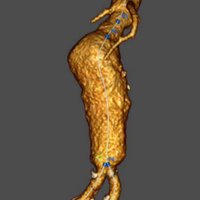 Imperial College London Vascular Surgery (@imperialvasc) 's Twitter Profile