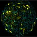 Martin-Villalba Lab (@molneurolab) Twitter profile photo Martin-Villalba Lab (@molneurolab) Twitter profile photo