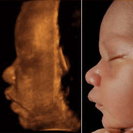 3d4dultrasounds's profile picture. 3D Ultrasound 4D Ultrasound