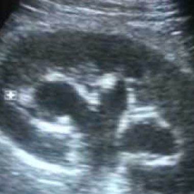 Sonographer with 15 years experience, spreading the joy of ultrasound and sharing ideas and good practice.