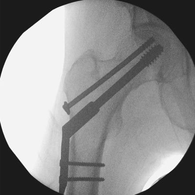 The Trauma & Orthopaedic Department at Homerton University Hospital provides Orthopaedic Services in Hackney & Stratford.