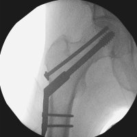 Homerton Orthopaedics(@HUHOrthopaedics) 's Twitter Profile Photo