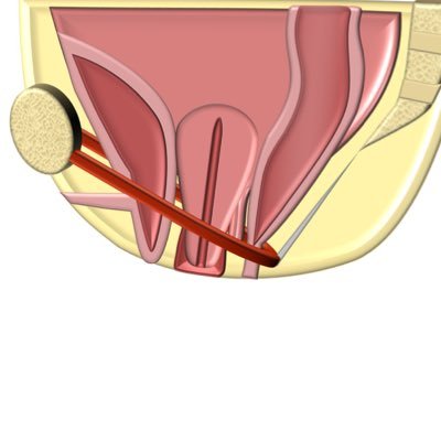 Official Twitter account of the Society of Abdominal Radiology (SAR) Pelvic Floor Dysfunction Disease-Focused Panel