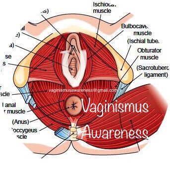 Information and discussion and support on Vaginismus for anyone suffering . Cured by PT 2016 and cured hypertonic pelvic floor dysfunction.