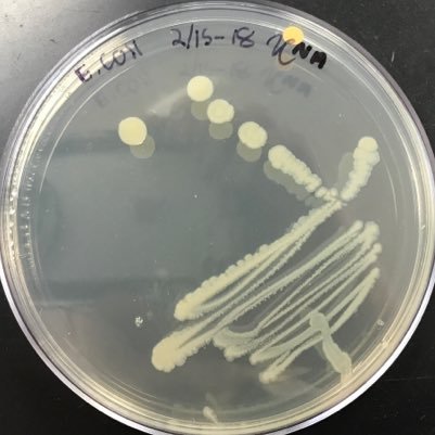 Hey everyone EscherichiaColi just entered the building contaminating everybody’s food! If you look at the top of my pfp you can see @_B_Mega_ photobombing me.😆