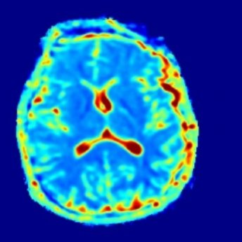 Department of Radiology