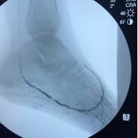 Scott Brannan, MD (@drarteryopener) 's Twitter Profile