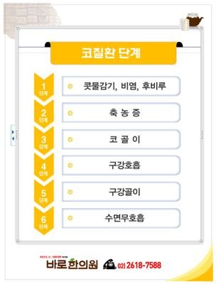 비염은 성장장애, 학습장애                                       
코골이는 고혈압, 심장병, 중풍, 치매를 일으킬 수 있는 심각한 질환 입니다