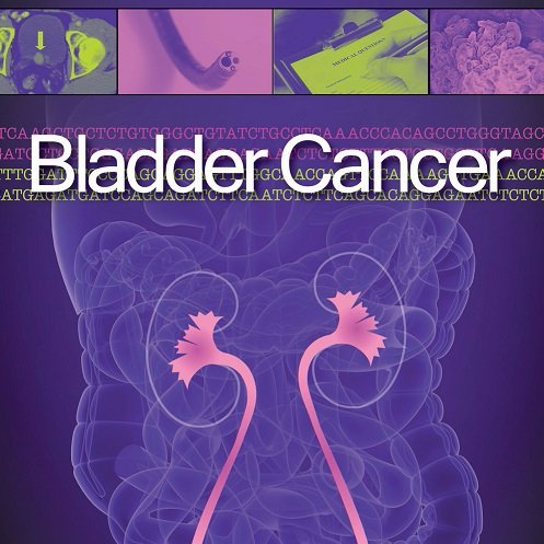 BLC Journal | Dedicated to expediting our understanding & improving treatments of bladder and upper urinary tract cancers | Editors Seth Lerner, Dan Theodorescu