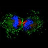 The Membrane Traffic and Cell Division Lab @InstitutPasteur studies #cytokinesis #CellDivision #MembraneTraffic #Rab35 #ESCRT #actin #septins