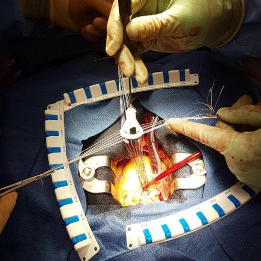 Leaders in Heart Surgery Profile