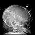 Collaborative for Research on Acute Neuro Injury (@uc_crani) Twitter profile photo Collaborative for Research on Acute Neuro Injury (@uc_crani) Twitter profile photo
