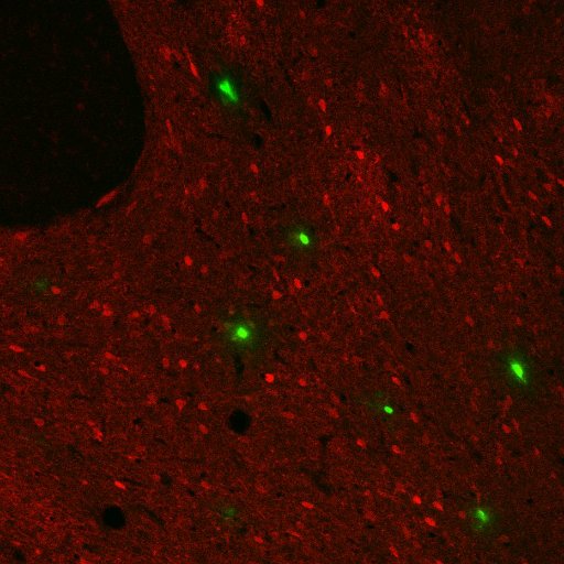 EtOH Substance Use Disorder research lab focused on synaptic alterations during protracted withdrawal. Electrophysiology, protein trafficking, dendritic spines.