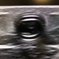 Rush Dialysis Access (@rush_dialaccess) 's Twitter Profile