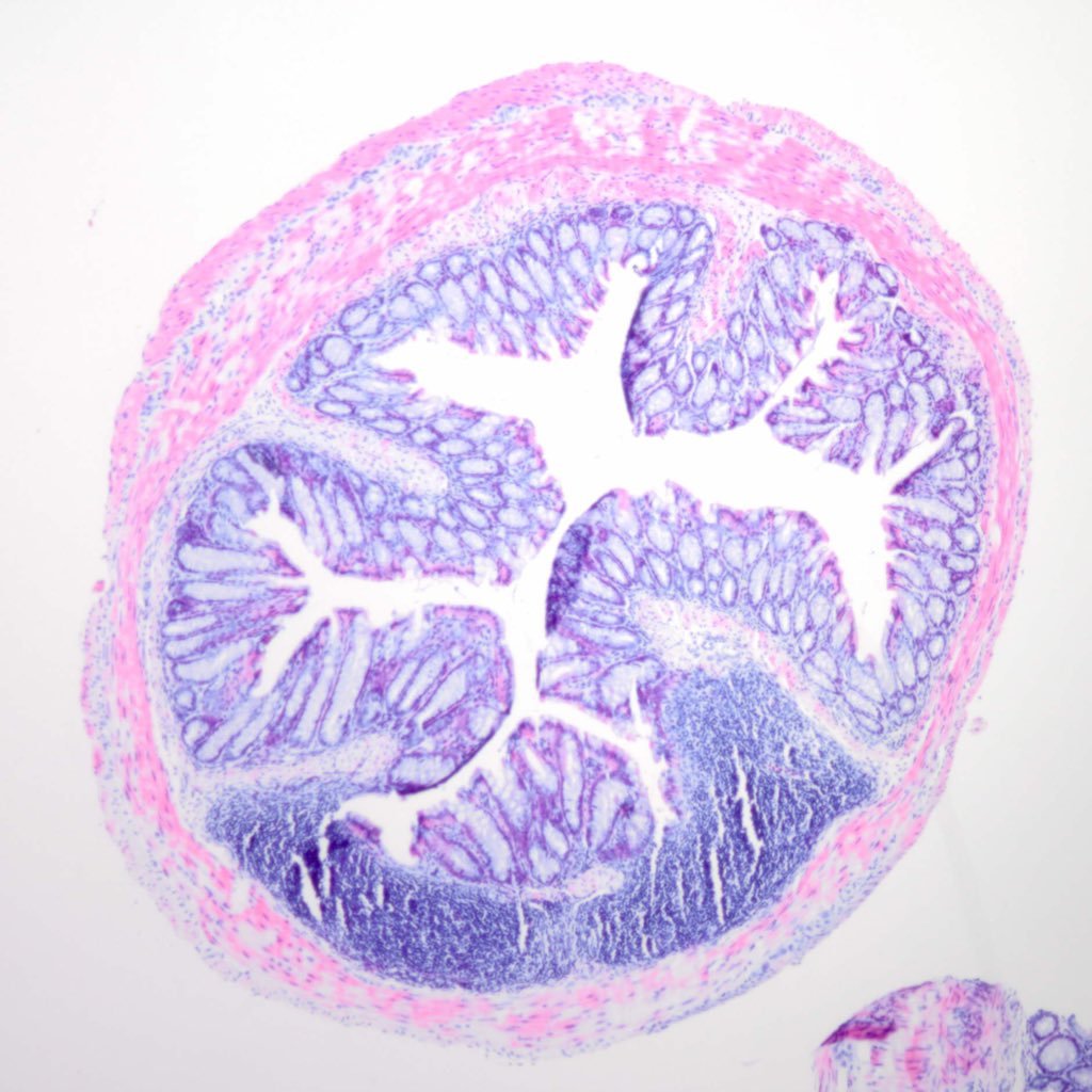 Mucosal immunology group with @s_milling at @UofGSii
Interested in the intestine's role in human disease (alopecia, IBD, axSpA) & dendritic cells in the gut