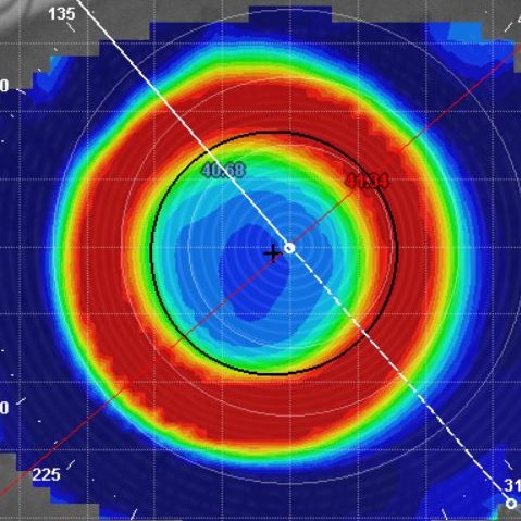 CaryEyeCare's profile picture. Comprehensive family eye care in Cary, NC.  We are committed to patient satisfaction, and providing the latest technology in glasses and contact lenses.