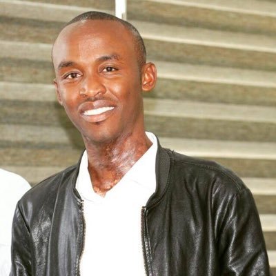 cyclinembithi's profile picture. Paraffin Burn Survivor.