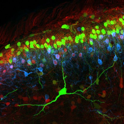 Spinal Cord Group Profile