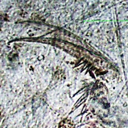 動物プランクトンを対象に陸水学や生態学を研究しています。現在は主に湖沼堆積物中の枝角類の遺骸・休眠卵を用いた研究や動プ自動判別の研究を行っております。アイコンは堆積物から検出したミジンコ(Daphnia pulex)の尾爪です。恐れ入りますが、通知やDMはほぼ気づきません。お手数ですが急ぎの要件はメールでお願い致します