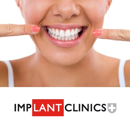 Clínica dental en Valencia. Especialistas en implantes de carga inmediata.