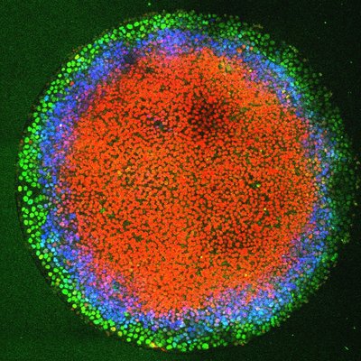 Keystone Symposia on X: Scholarships for Vertebrate