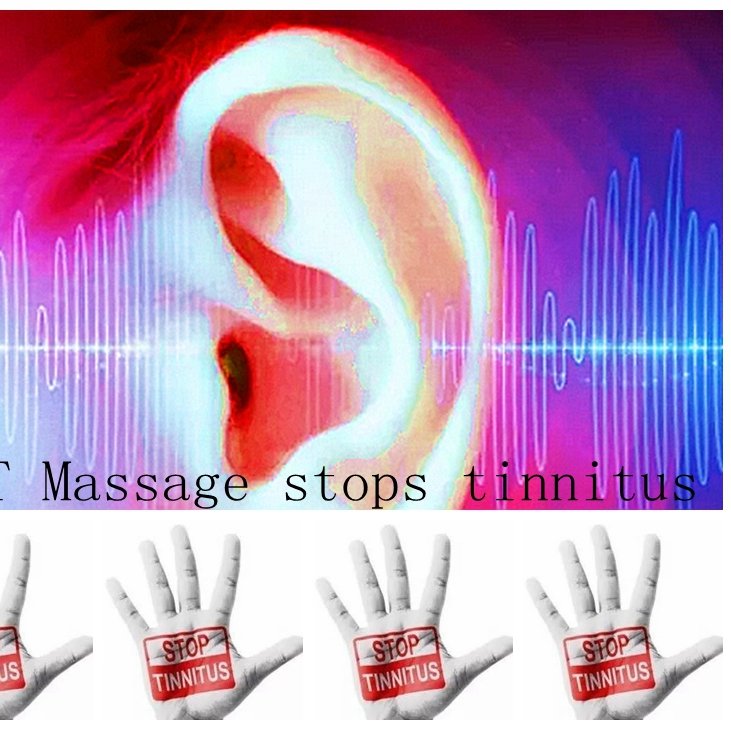 Focus on the rehabilitation of tinnitus and IBS has been 23 years. Massage acupuncture points to eliminate tinnitus and diarrhea.