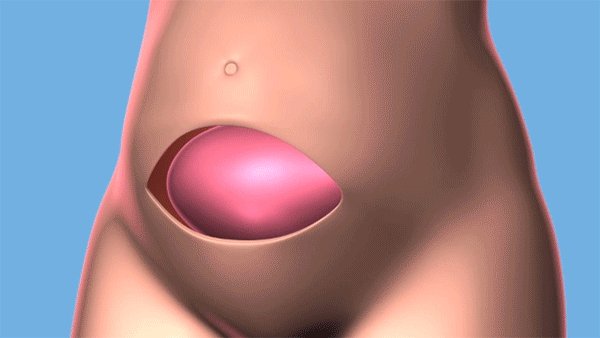 Cleveland Clinic successfully performed its first in utero fetal surgery to repair a spina bifida birth defect.
https://cle.clinic/2IQ3aCP