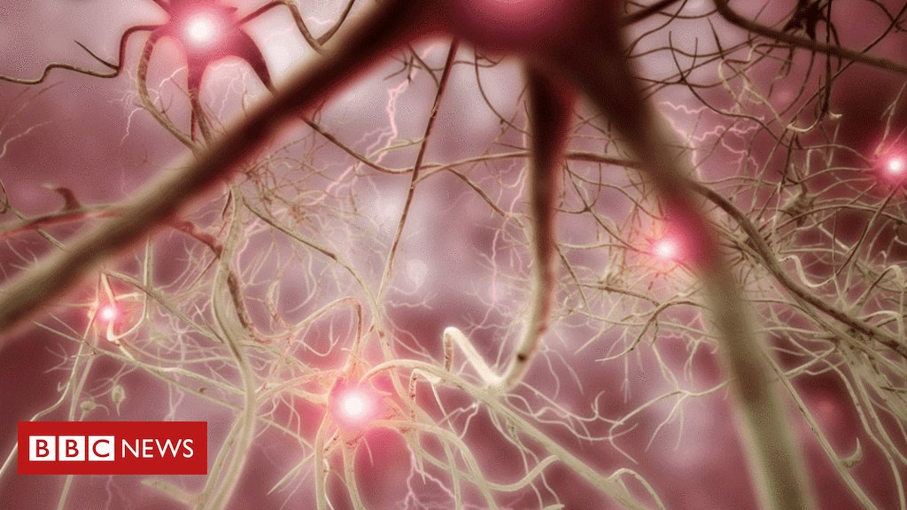 Zubair Rafiq (@_zrafiq_) on Twitter photo 2019-07-17 12:15:51 Elon Musk reveals brain-hacking plans bbc.in/2XTvdXD Elon Musk reveals brain-hacking plans bbc.in/2XTvdXD