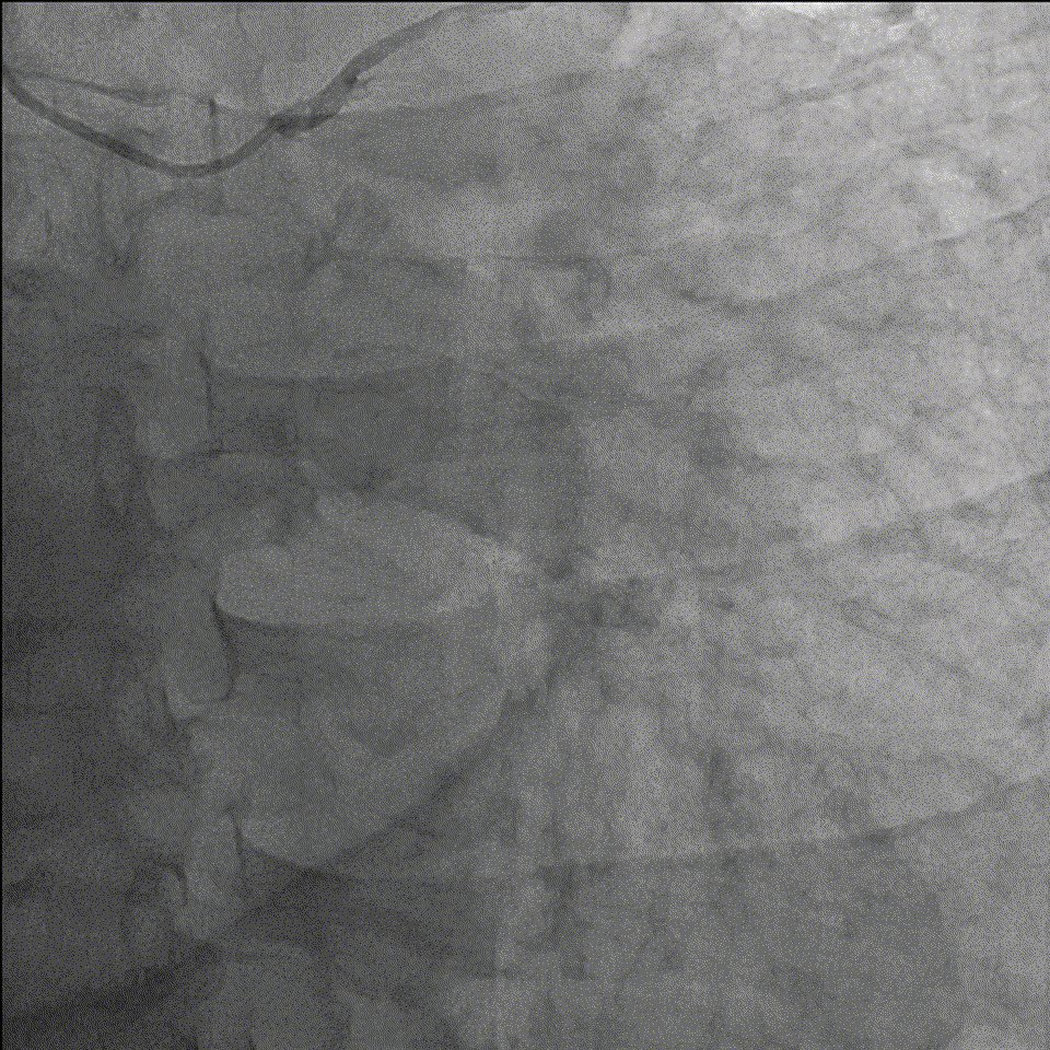 Allen Jeremias on Twitter "Watch the legendary JWMoses and yours