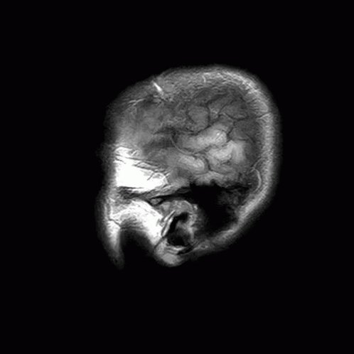 Brain Scan GIF