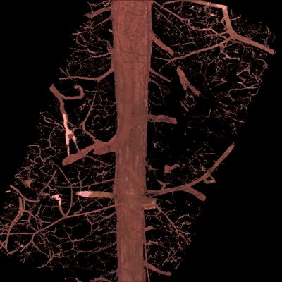 3D microscopy and animation of a breast duct