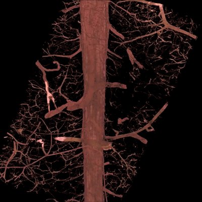 3D microscopy and animation of a breast duct