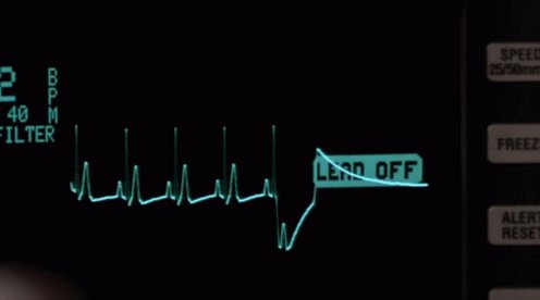 Ekg Machine GIF