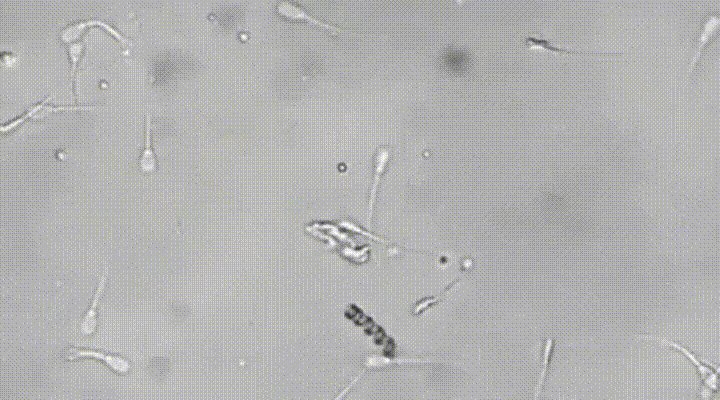 A nanobot picks up a lazy sperm by the tail and inseminates an egg with it, by the German Institute for Integrative Nanosciences. https://t.co/SQl7WxllAj