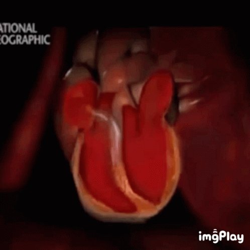 Ventricular Fibrillation GIF