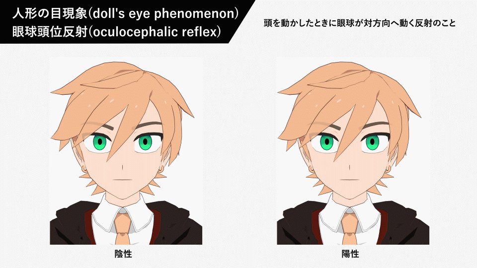 Yukanuntiusel 人形の目現象について メモ Yukanuntiusel 人形の目現象について メモ
