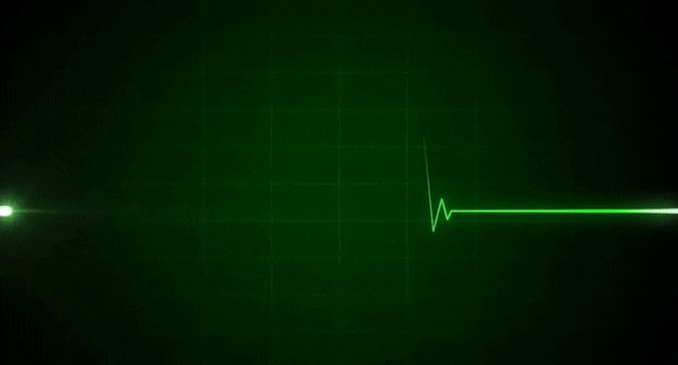 heartbeat GIF