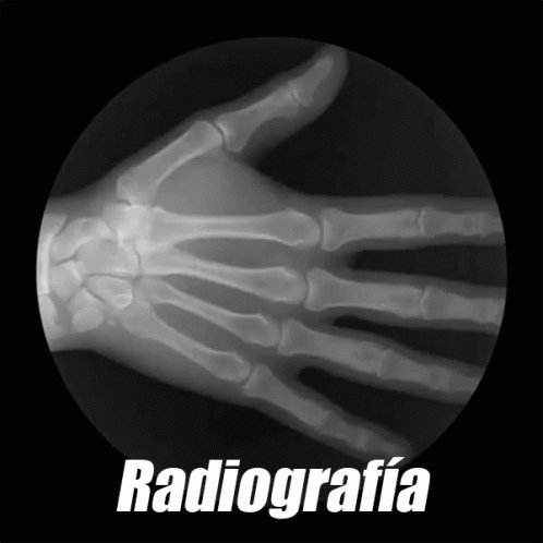 Radiografía De Mano GIF