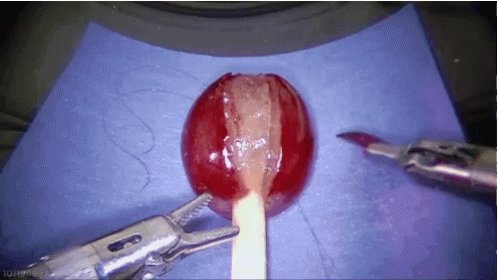 Surgery Grape GIF