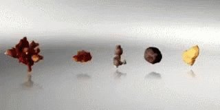 Different Kinds Of Kidney Stones GIF