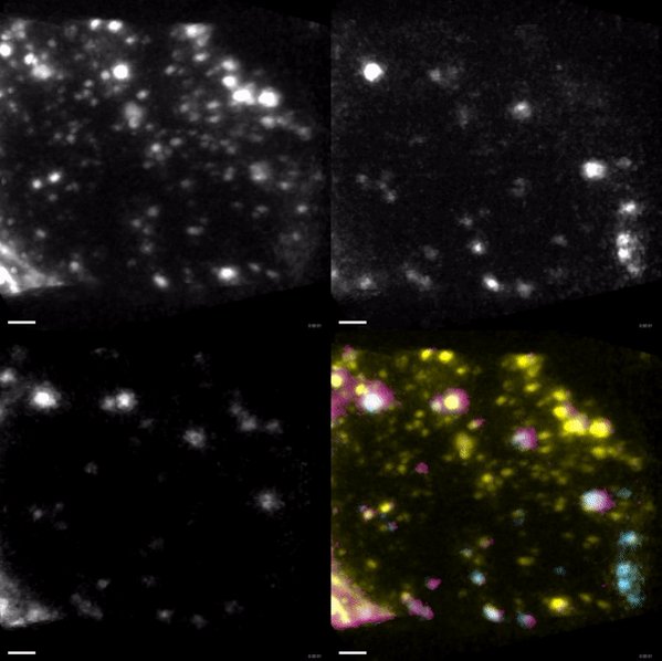 Three endosomal markers - APPL1, EEA1 and Rab5 are tagged. M