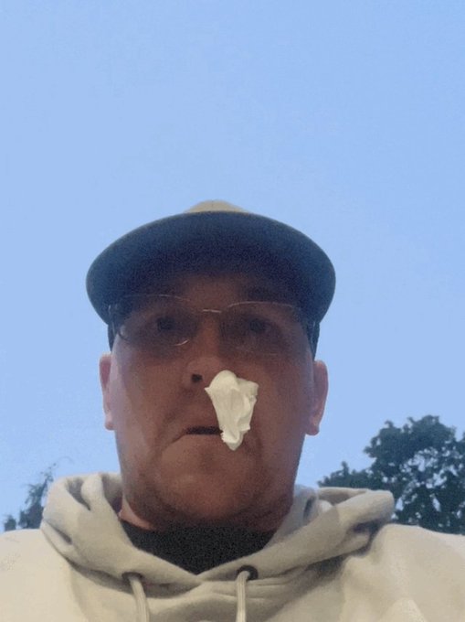 This is what happens when restaurants put too much salt on the food. Blood pressure spikes https://t