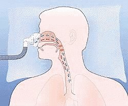 Cpap Machine GIF