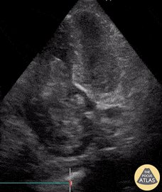 Today’s Tweetorial is on DVT!

@icmteaching and @ICUltrasonica take you through it.

-5-10% of ICU p...